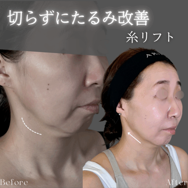 No.8887の症例写真